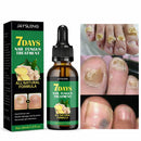 UTILIFFY BEAUTY™ – Tratamiento antimicótico para las uñas en 7 días | Fórmula natural reparadora